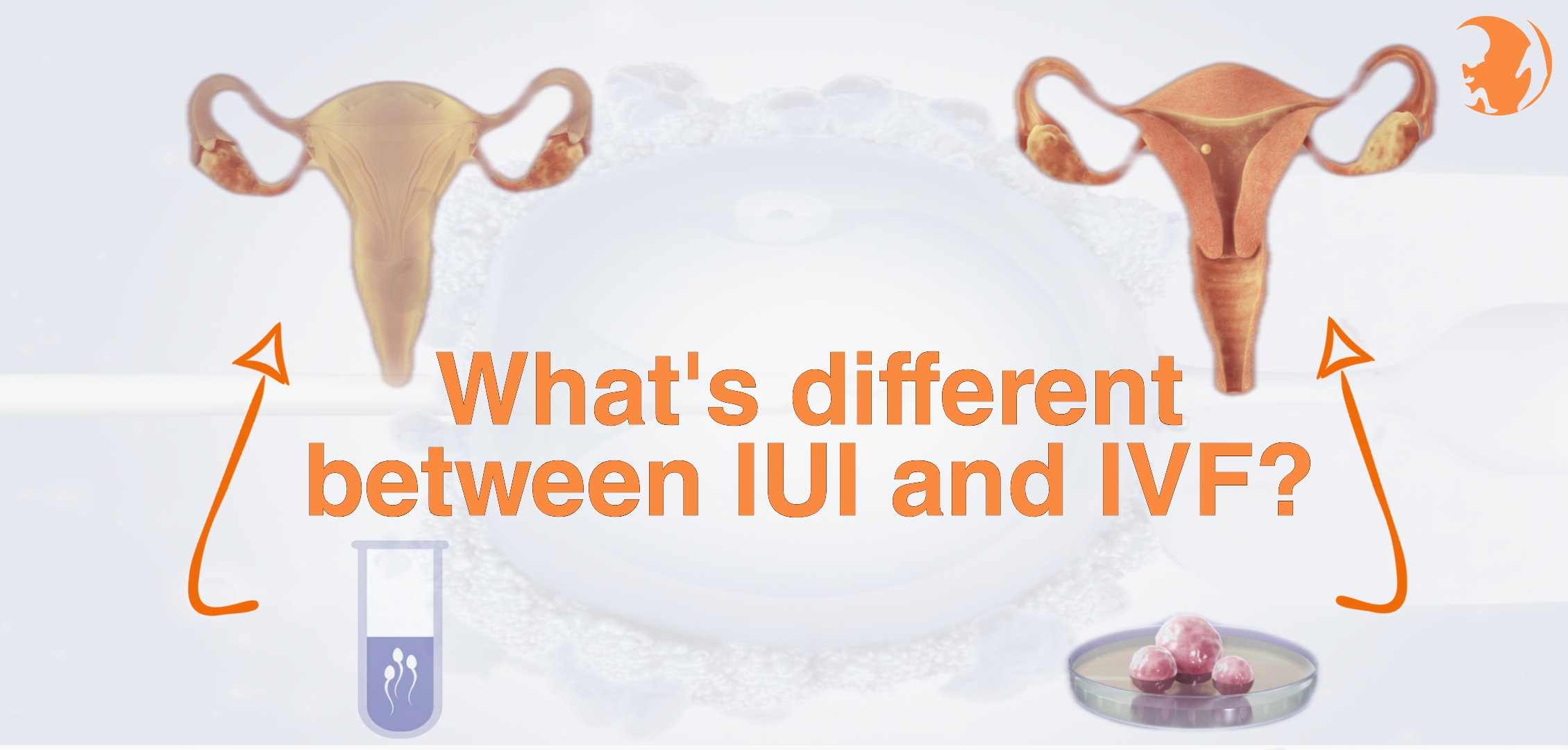 IUI vs IVF fertility treatments comparison