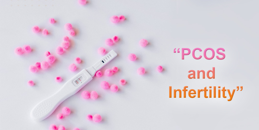 PCOS symptoms and fertility effects