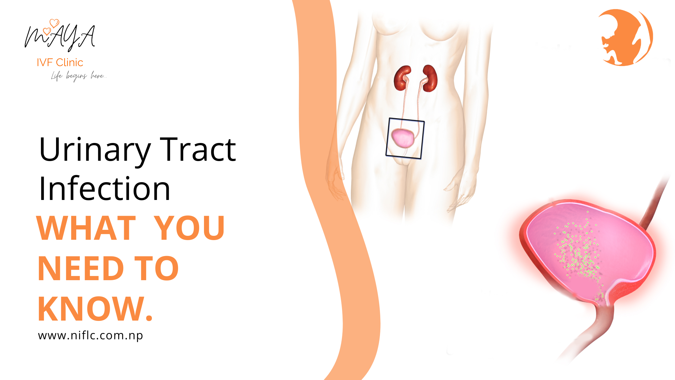 Urinary Tract Infection UTI symptoms and treatment