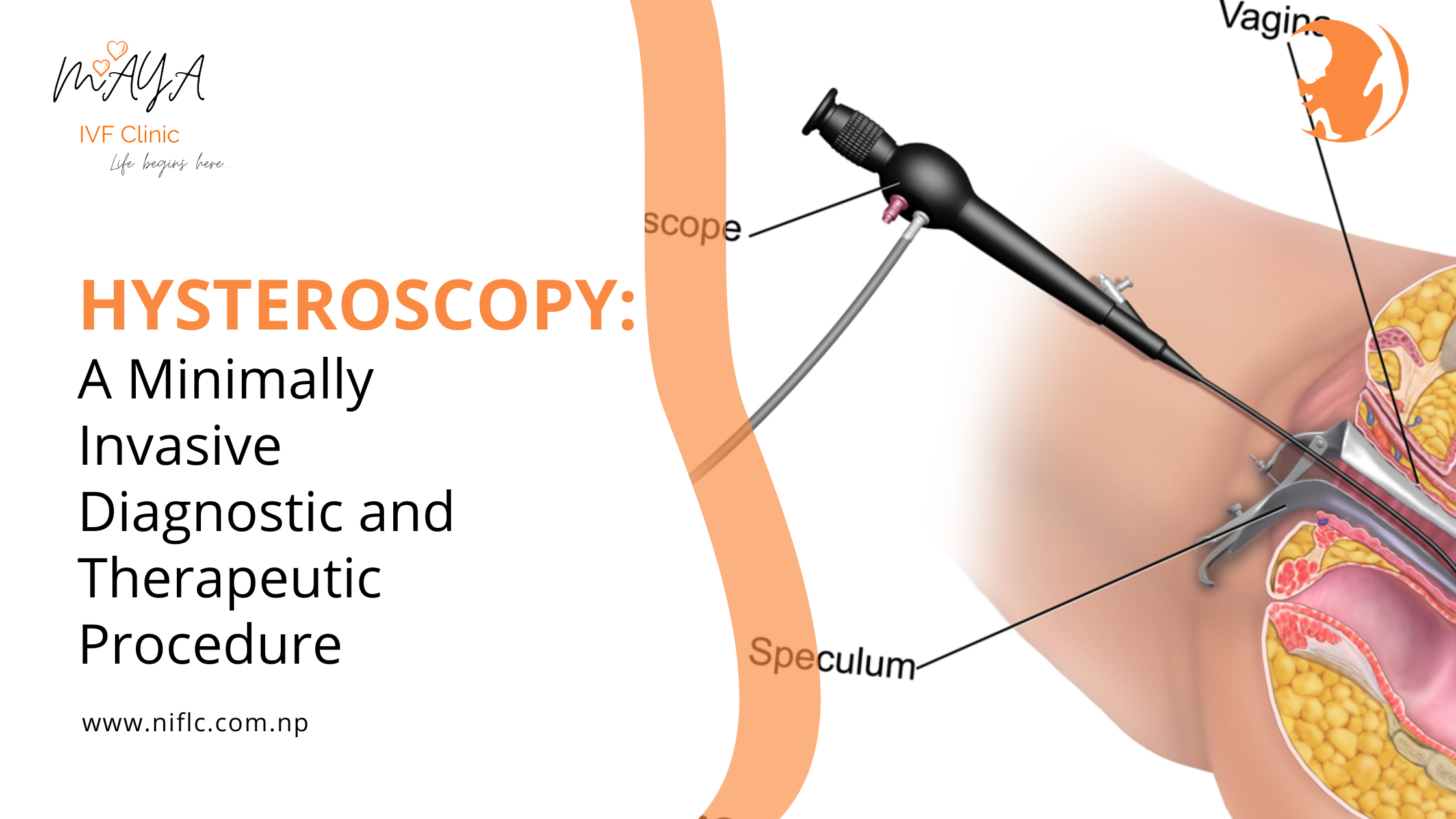 Hysteroscopy